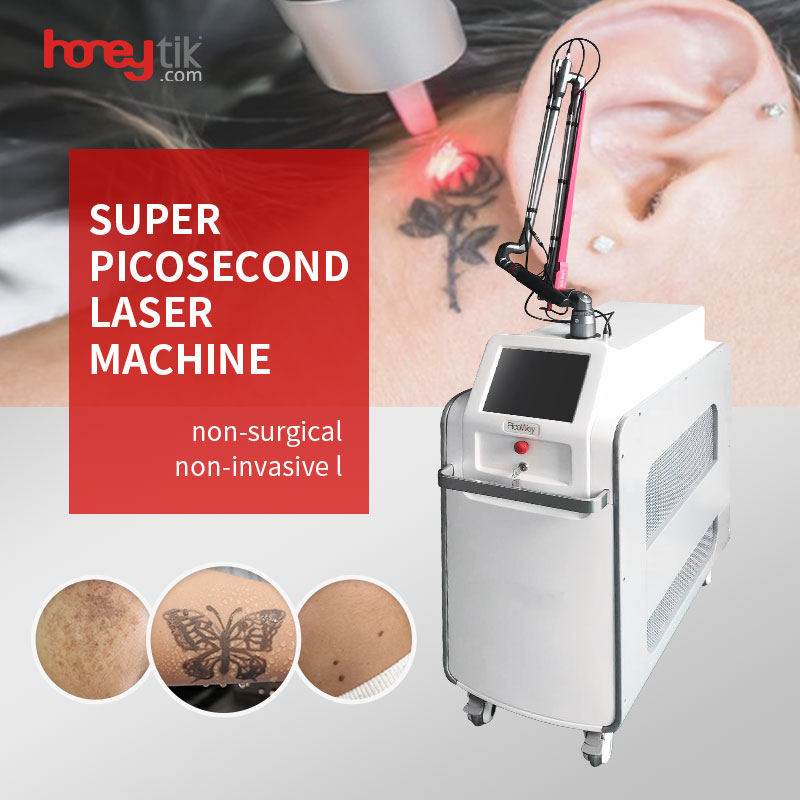 Laser Tattoo Removal Cost 532nm 755nm 1064nm Nd Yag